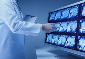 Risk of Stroke 10-fold Increased for Recent TBI Victims