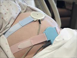 Fetal Monitoring Strips